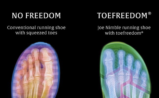 Wir nennen es Toefreedom